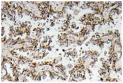 CRH Rabbit anti-Human, Polyclonal Antibody, Abnova 100 &mu;L | Buy Online | Abnova Corporation | Fisher Scientific