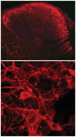 TAC1, Guinea pig, Polyclonal Antibody, Abnova 50 &mu;L | Buy Online | Abnova Corporation | Fisher Scientific