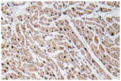 CXCL3, Rabbit, Polyclonal Antibody, Abnova 100&mu;L; Unlabeled:Antibodies,