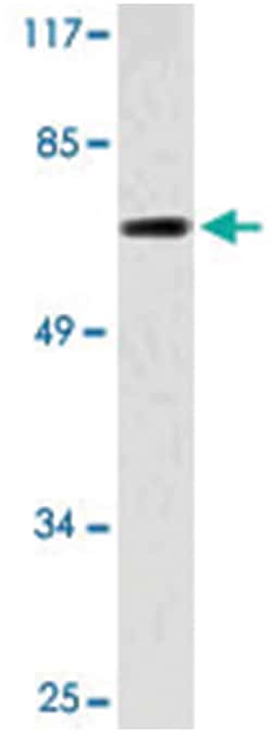 CDC7, Rabbit, Polyclonal Antibody, Abnova 100 &mu;L | Buy Online | Abnova Corporation | Fisher Scientific