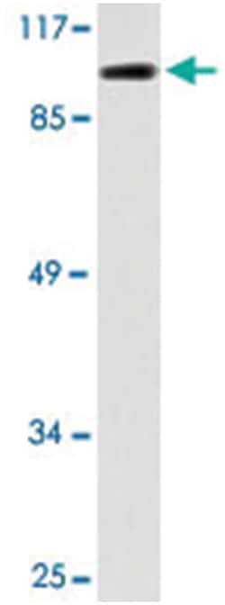 DGKQ Rabbit anti-Human, Polyclonal Antibody, Abnova 100 &mu;L | Buy Online | Abnova Corporation | Fisher Scientific