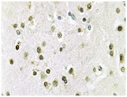 DGKQ Rabbit anti-Human, Polyclonal Antibody, Abnova 100 &mu;L | Buy Online | Abnova Corporation | Fisher Scientific