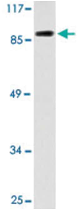 AKAP1, Rabbit, Polyclonal Antibody, Abnova 100 &mu;L | Buy Online | Abnova Corporation | Fisher Scientific