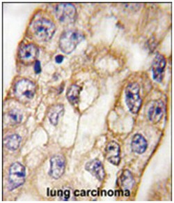 CD8A Rabbit anti-Human, Polyclonal Antibody, Abnova 400 &mu;L | Buy Online | Abnova Corporation | Fisher Scientific