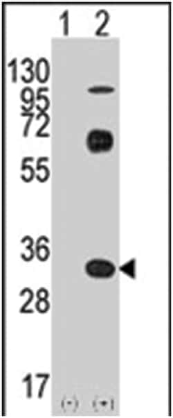 CD8A Rabbit anti-Human, Polyclonal Antibody, Abnova 400 &mu;L | Buy Online | Abnova Corporation | Fisher Scientific
