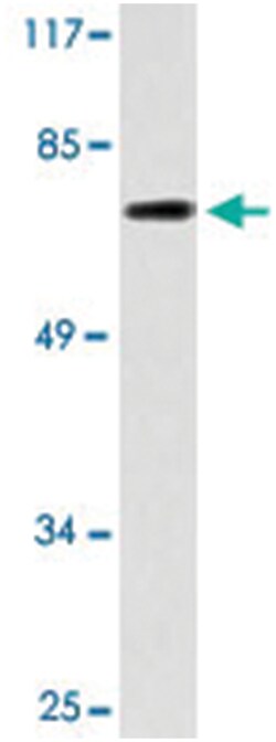 GAS6, Rabbit, Polyclonal Antibody, Abnova 100 &mu;L | Buy Online | Abnova Corporation | Fisher Scientific