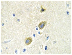 GAS6, Rabbit, Polyclonal Antibody, Abnova 100 &mu;L | Buy Online | Abnova Corporation | Fisher Scientific
