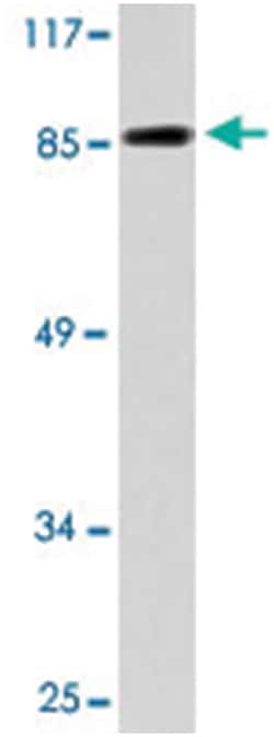 CDH3 Rabbit anti-Human, Polyclonal Antibody, Abnova 100 &mu;L | Buy Online | Abnova Corporation | Fisher Scientific