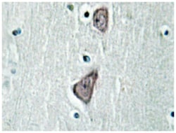 CDH3 Rabbit anti-Human, Polyclonal Antibody, Abnova 100 &mu;L | Buy Online | Abnova Corporation | Fisher Scientific