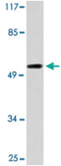 HTR2B Rabbit anti-Human, Polyclonal Antibody, Abnova 100 &mu;L | Buy Online | Abnova Corporation | Fisher Scientific