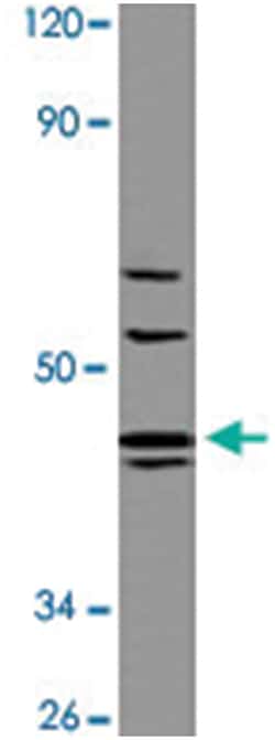 AGTR1 Rabbit anti-Human, Mouse, Rat, Polyclonal Antibody, Abnova 100&mu;L;