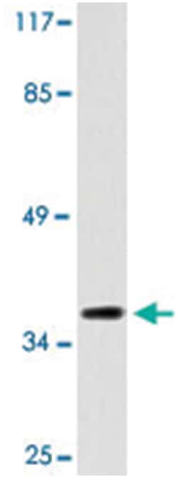 GPR119 Rabbit anti-Human, Polyclonal Antibody, Abnova 100&mu;L; Unlabeled:Antibodies,