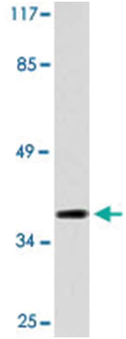 MCHR2, Rabbit, Polyclonal Antibody, Abnova 100&mu;L; Unlabeled:Antibodies,