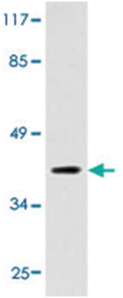 PRKAR2A, Rat, Polyclonal Antibody, Abnova 100 &mu;L | Buy Online | Abnova | Fisher Scientific