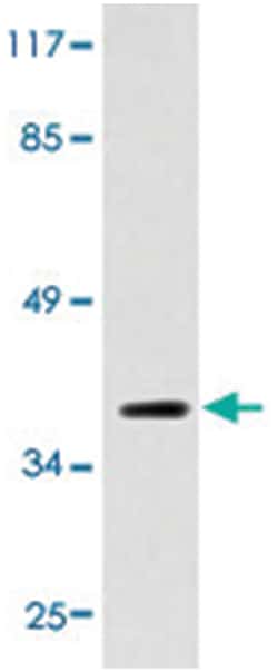 RAD51, Rat, Polyclonal Antibody, Abnova 100&mu;L; Unlabeled:Anticuerpos