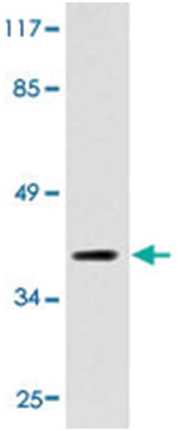 Rat anti-CXCR3, Polyclonal, Abnova 100 &mu;L | Buy Online | Abnova Corporation | Fisher Scientific