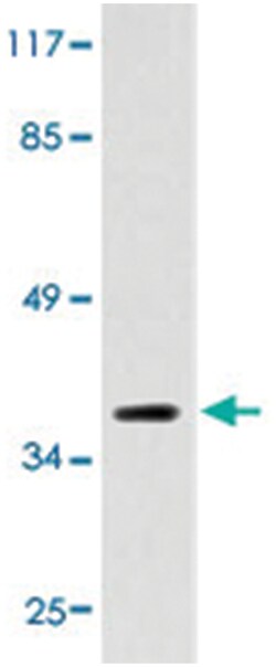 LPAR2, Rat, Polyclonal Antibody, Abnova 100&mu;L; Unlabeled:Antibodies,