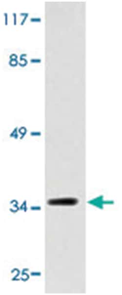 MC1R, Rabbit, Polyclonal Antibody, Abnova 100&mu;L; Unlabeled:Antibodies,