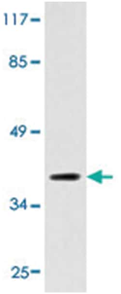 MTNR1B Rabbit anti-Human, Polyclonal Antibody, Abnova 100 &mu;L | Buy Online | Abnova Corporation | Fisher Scientific