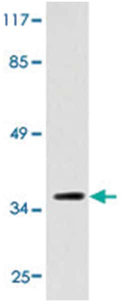 RRH Rabbit anti-Human, Polyclonal Antibody, Abnova 100 &mu;L | Buy Online | Abnova Corporation | Fisher Scientific