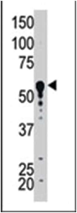 SPTLC1 Rabbit anti-Human, Polyclonal Antibody, Abnova 400&mu;L; Unlabeled:Antibodies,