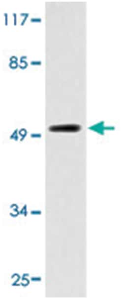 EMR4P, Rabbit, Polyclonal Antibody, Abnova 100 &mu;L | Buy Online | Abnova Corporation | Fisher Scientific