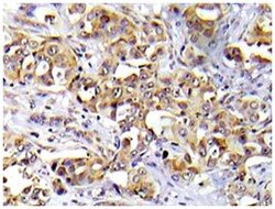 ATM Rabbit anti-Human, Polyclonal Antibody, Abnova 100 &mu;L | Buy Online | Abnova Corporation | Fisher Scientific