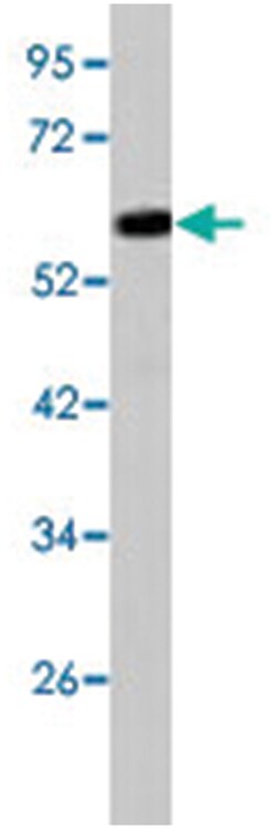 ACSL3 Rabbit anti-Human, Polyclonal Antibody, Abnova 400&mu;L; Unlabeled:Antibodies,