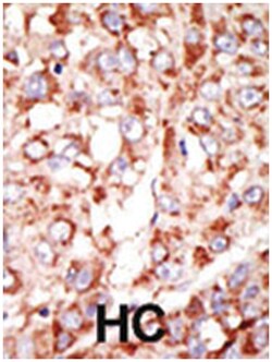 ACSL3 Rabbit anti-Human, Polyclonal Antibody, Abnova 400&mu;L; Unlabeled:Antibodies,