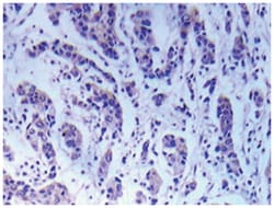 MAP3K5 Rabbit anti-Human, Polyclonal Antibody, Abnova 100 &mu;L | Buy Online | Abnova Corporation | Fisher Scientific