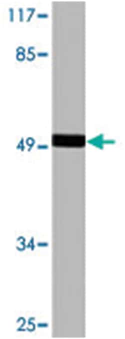 F2R Rabbit anti-Human, Polyclonal Antibody, Abnova 100 &mu;L | Buy Online | Abnova Corporation | Fisher Scientific