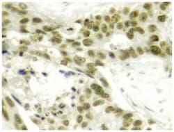 AR (phospho S213), Rabbit anti-Human, Polyclonal Antibody, Abnova 100 &mu;L | Buy Online | Abnova Corporation | Fisher Scientific