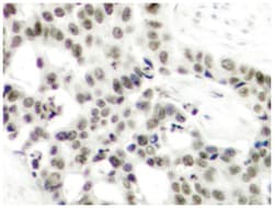 AR (phospho S650), Rabbit anti-Human, Polyclonal Antibody, Abnova 100 &mu;L | Buy Online | Abnova | Fisher Scientific