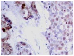 ATF4 (phospho S245), Rabbit anti-Human, Polyclonal Antibody, Abnova 100 &mu;L | Buy Online | Abnova | Fisher Scientific