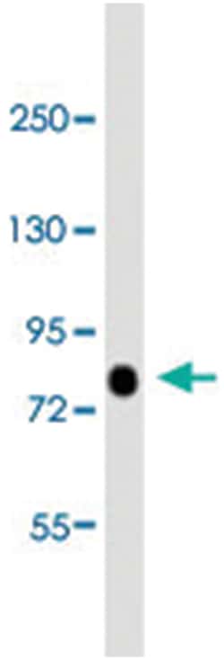 ACSL4, Rabbit, Polyclonal Antibody, Abnova 400&mu;L; Unlabeled:Antibodies,