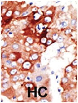 ACSL4, Rabbit, Polyclonal Antibody, Abnova 400&mu;L; Unlabeled:Antibodies,