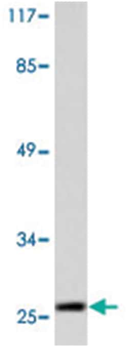 HSPB1 (phospho S15), Rabbit anti-Human, Polyclonal Antibody, Abnova 100 &mu;L | Buy Online | Abnova | Fisher Scientific