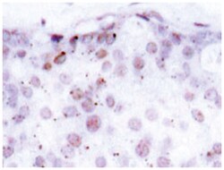 NFKB1 (phospho S907), Rabbit anti-Human, Polyclonal Antibody, Abnova 100&mu;L;