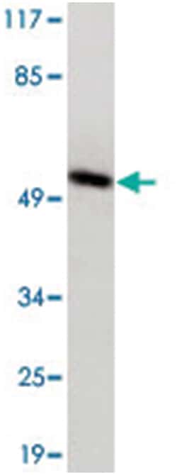 IRF3 (phospho S385), Rabbit anti-Human, Polyclonal Antibody, Abnova 100&mu;L;