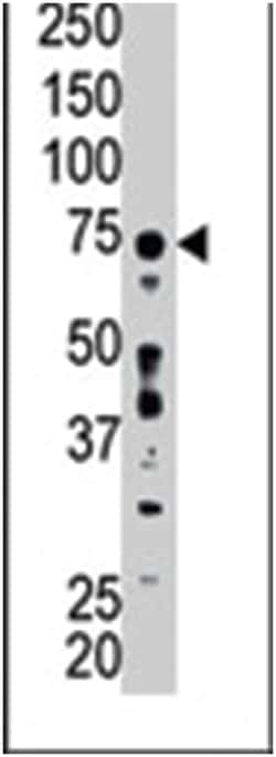 ACSL6, Rabbit, Polyclonal Antibody, Abnova 400&mu;L; Unlabeled:Antibodies,