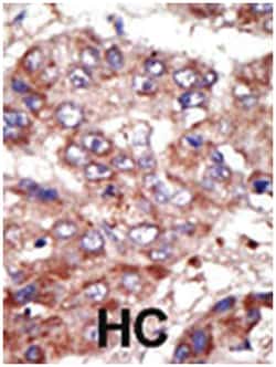 ACSL6, Rabbit, Polyclonal Antibody, Abnova 400&mu;L; Unlabeled:Antibodies,