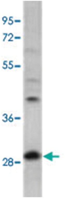 PPT1 Rabbit anti-Human, Mouse, Polyclonal Antibody, Abnova 400&mu;L; Unlabeled:Antibodies,