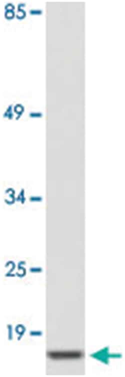 UTS2 Rabbit anti-Human, Polyclonal Antibody, Abnova 100 &mu;L | Buy Online | Abnova | Fisher Scientific