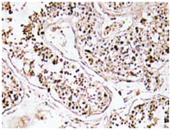 VIP Rabbit anti-Human, Polyclonal Antibody, Abnova 100&mu;L; Unlabeled:Antibodies,
