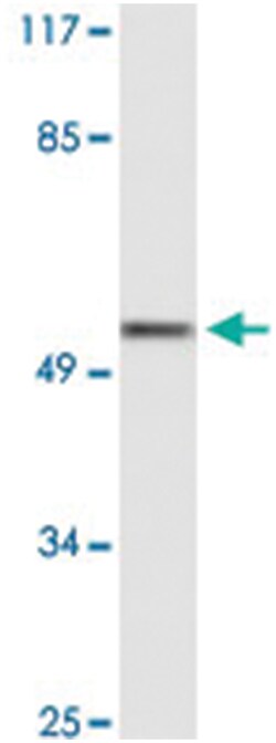 GDF9 Rabbit anti-Human, Polyclonal Antibody, Abnova 100&mu;L; Unlabeled:Antibodies,