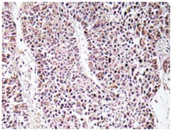 GDF9 Rabbit anti-Human, Polyclonal Antibody, Abnova 100&mu;L; Unlabeled:Antibodies,