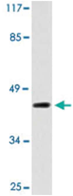 AVPR1B Rabbit anti-Human, Polyclonal Antibody, Abnova 100 &mu;L | Buy Online | Abnova Corporation | Fisher Scientific