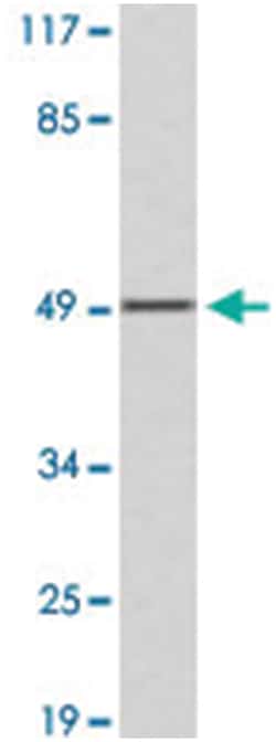 FGL2, Rabbit, Polyclonal Antibody, Abnova 100&mu;L; Unlabeled:Antibodies,