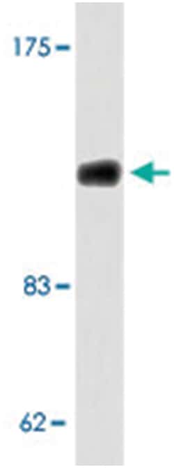 CSF1R Rabbit anti-Human, Polyclonal Antibody, Abnova 100 &mu;L | Buy Online | Abnova Corporation | Fisher Scientific