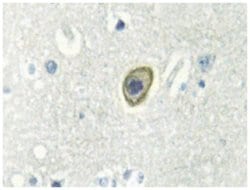 CSF1R Rabbit anti-Human, Polyclonal Antibody, Abnova 100 &mu;L | Buy Online | Abnova Corporation | Fisher Scientific